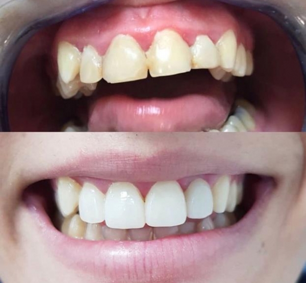 Clinicas Dentales Estepona