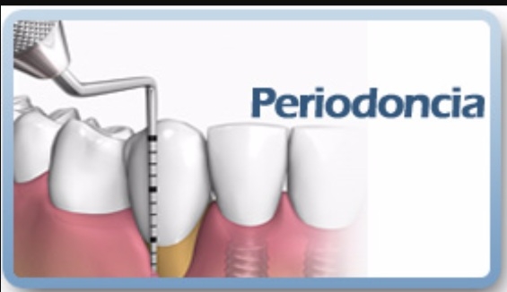 periodoncia fuengirola